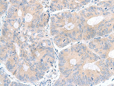 UBE2F Polyclonal Antibody Reactivity Human