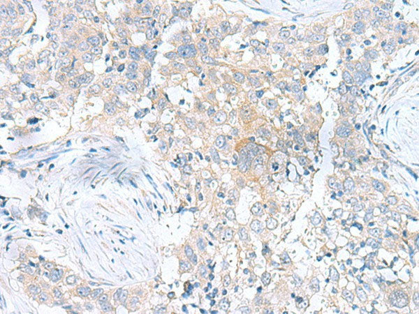 UBE2F Polyclonal Antibody Reactivity Human