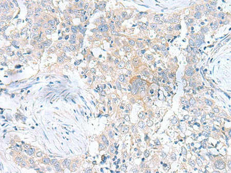 UBE2F Polyclonal Antibody Reactivity Human