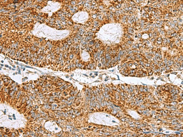 MRPS28 Polyclonal Antibody Reactivity Human