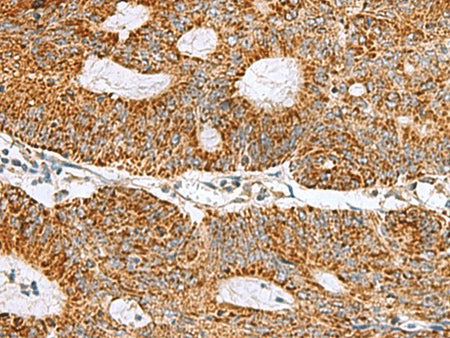 MRPS28 Polyclonal Antibody Reactivity Human