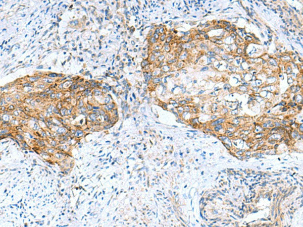 MRPS28 Polyclonal Antibody Reactivity Human