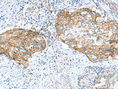 MRPS28 Polyclonal Antibody Reactivity Human