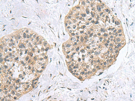 RPL18 Polyclonal Antibody Reactivity Human