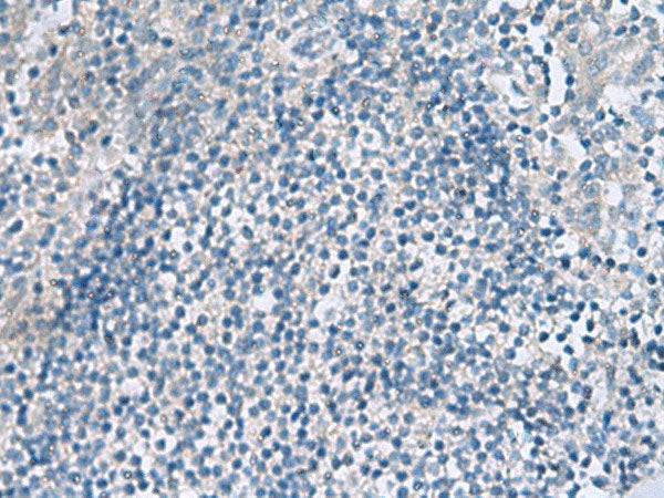 HPCAL1 Polyclonal Antibody Reactivity Human