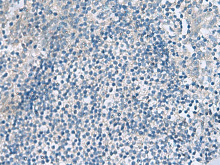 HPCAL1 Polyclonal Antibody Reactivity Human