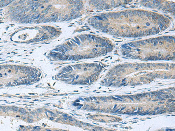 HPCAL1 Polyclonal Antibody Reactivity Human