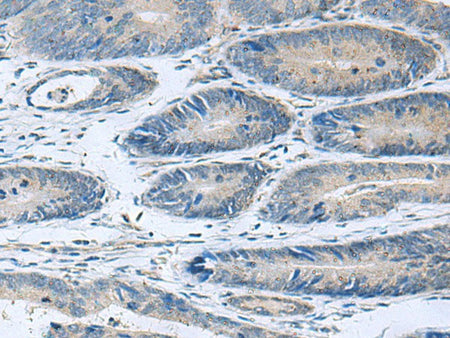 HPCAL1 Polyclonal Antibody Reactivity Human