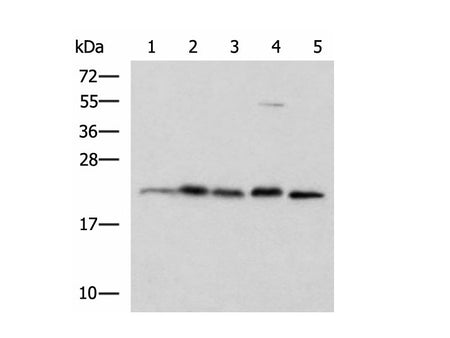 HPCAL1 Polyclonal Antibody Reactivity Human