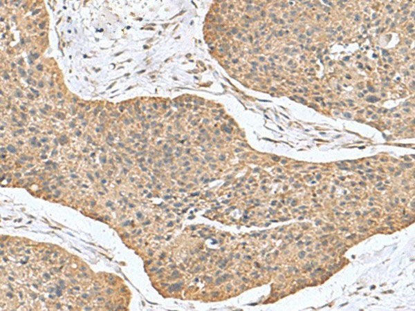 CSRP2 Polyclonal Antibody Reactivity Human