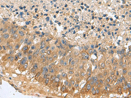 MARCKSL1 Polyclonal Antibody Reactivity Human