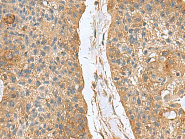MARCKSL1 Polyclonal Antibody Reactivity Human