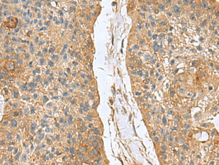 MARCKSL1 Polyclonal Antibody Reactivity Human