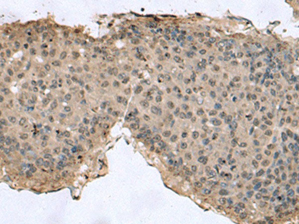 TMX3 Polyclonal Antibody Reactivity Human