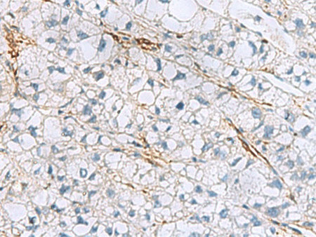 TAGLN3 Polyclonal Antibody Reactivity Human