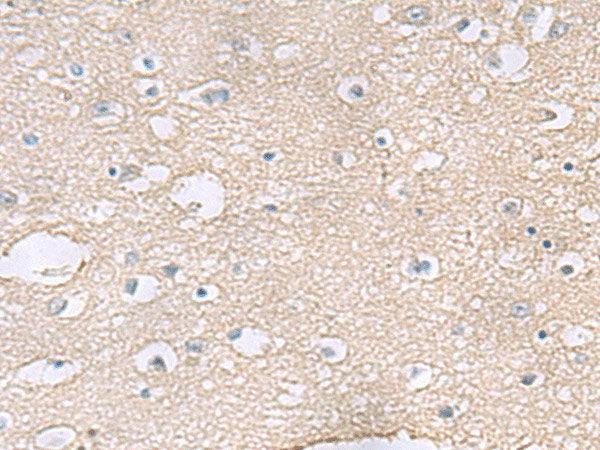 TAGLN3 Polyclonal Antibody Reactivity Human