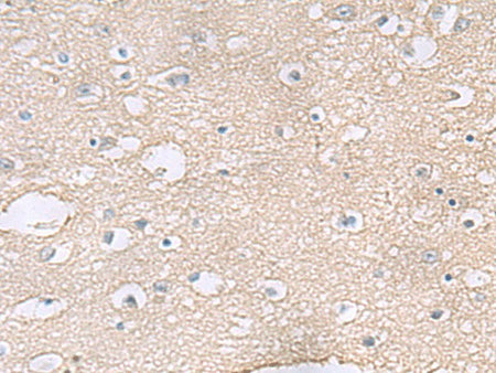 TAGLN3 Polyclonal Antibody Reactivity Human
