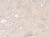 TAGLN3 Polyclonal Antibody Reactivity Human