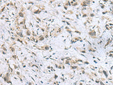 ITGB1BP1 Polyclonal Antibody Reactivity Human