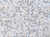 ITGB1BP1 Polyclonal Antibody Reactivity Human