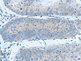 GUCA1A Polyclonal Antibody Reactivity Human