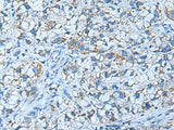 GUCA1A Polyclonal Antibody Reactivity Human