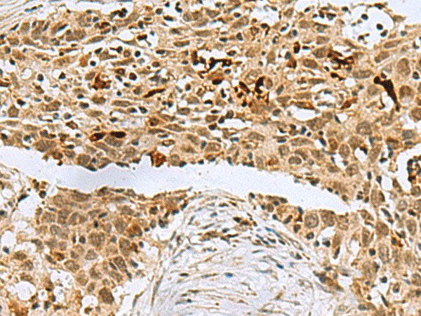 BCL7B Polyclonal Antibody Reactivity Human