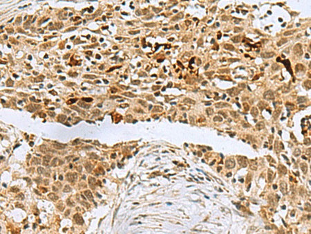 BCL7B Polyclonal Antibody Reactivity Human