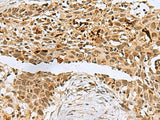 BCL7B Polyclonal Antibody Reactivity Human
