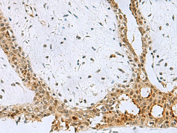 BCL7B Polyclonal Antibody Reactivity Human