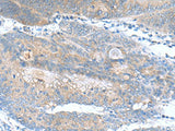 JOSD1 Polyclonal Antibody Reactivity Human