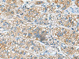 JOSD1 Polyclonal Antibody Reactivity Human