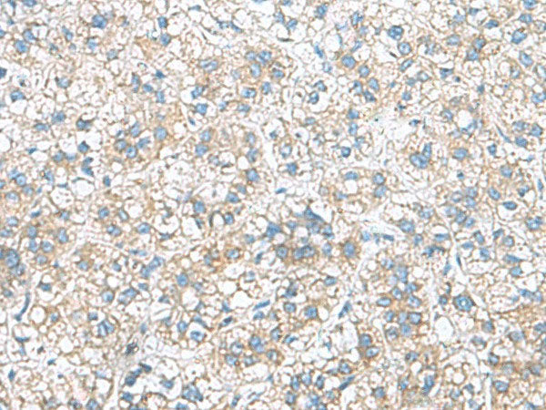 RAB13 Polyclonal Antibody Reactivity Human
