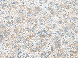 RAB13 Polyclonal Antibody Reactivity Human