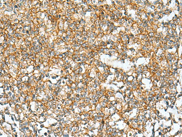 RAB13 Polyclonal Antibody Reactivity Human