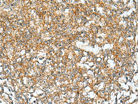 RAB13 Polyclonal Antibody Reactivity Human