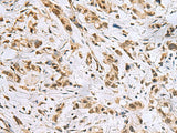 NABP1 Polyclonal Antibody Reactivity Human