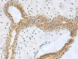NABP1 Polyclonal Antibody Reactivity Human
