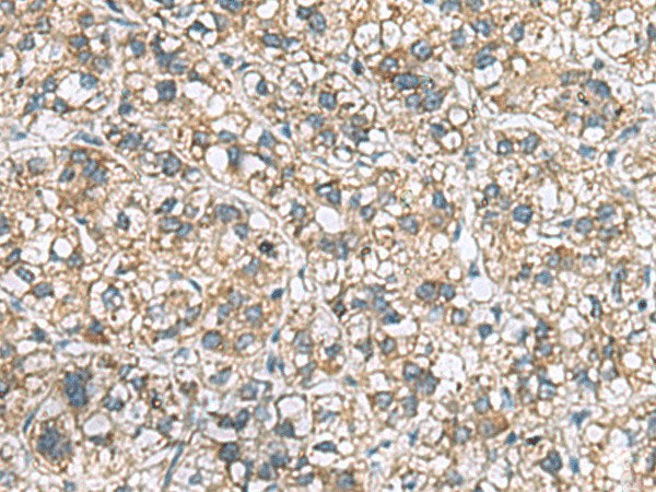 MRPL22 Polyclonal Antibody Reactivity Human
