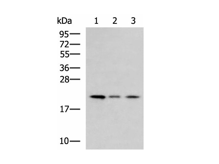 MRPL22 Polyclonal Antibody Reactivity Human