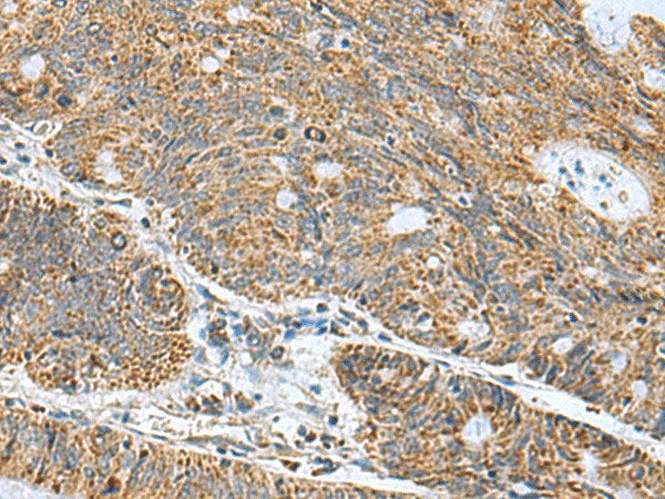 MRPL40 Polyclonal Antibody Reactivity Human