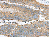 CLTB Polyclonal Antibody Reactivity Human