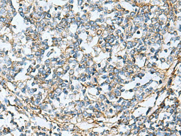 CLTB Polyclonal Antibody Reactivity Human
