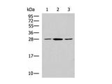 CLTB Polyclonal Antibody Reactivity Human
