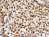 MYEF2 Polyclonal Antibody Reactivity Human