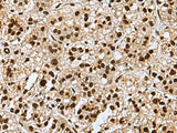 MYEF2 Polyclonal Antibody Reactivity Human
