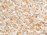 RAB38 Polyclonal Antibody Reactivity Human