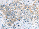 PPIC Polyclonal Antibody Reactivity Human