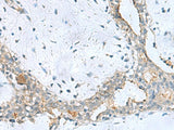 PPIC Polyclonal Antibody Reactivity Human