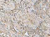 IGLL1 Polyclonal Antibody Reactivity Human